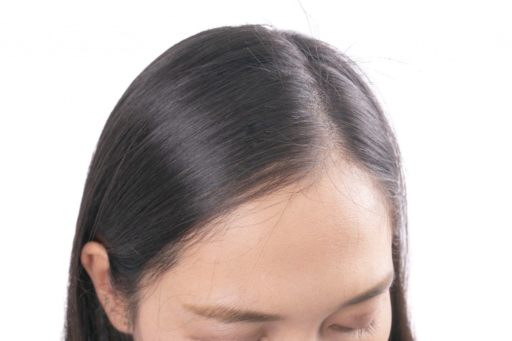 รักษาผมบาง จากสาเหตุ