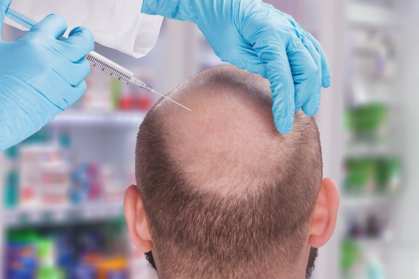 คลินิกผม