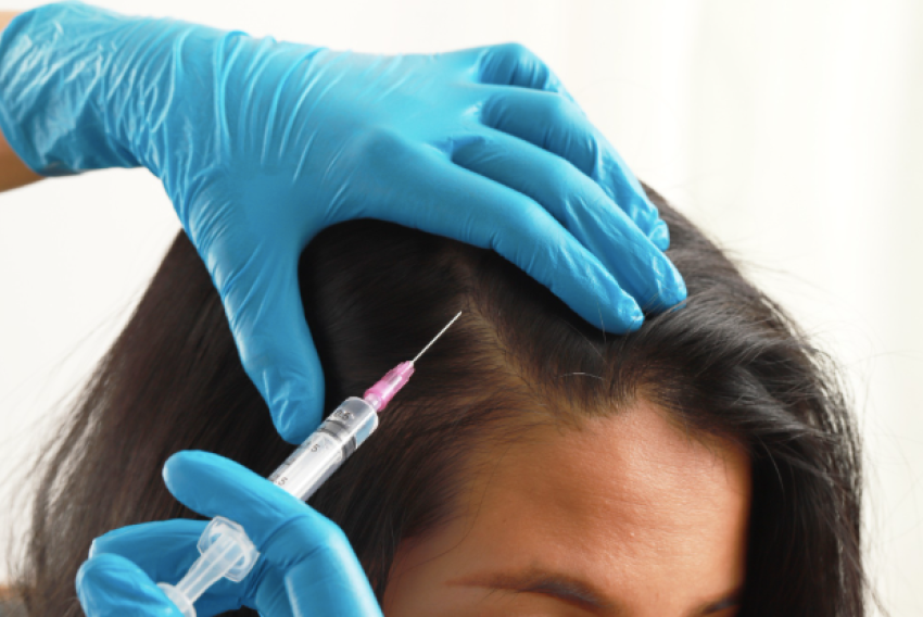 ปลูกผม ราคาแบบไหนคุ้ม